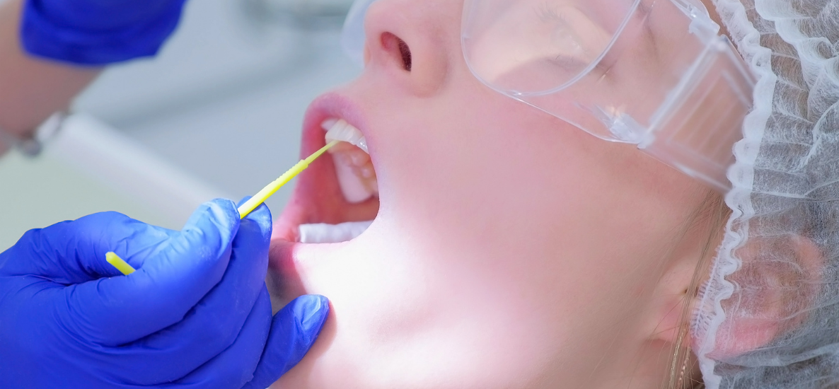 Fluoryzacja zębów - najczęściej stosowane preparaty