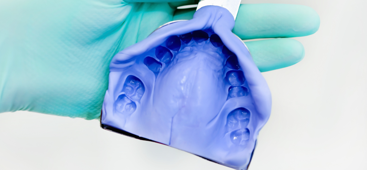 Rejestracja zwarcia bez błędów – sprawdź, które produkty warto mieć w codziennej praktyce stomatologicznej.