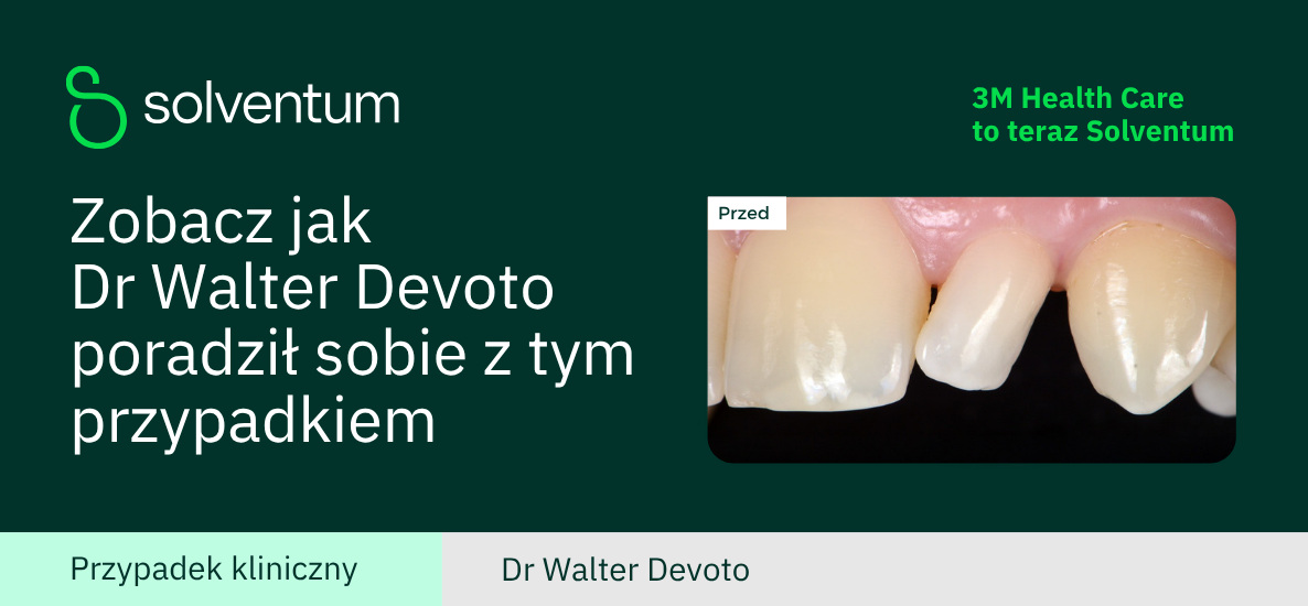 Odbudowa drugiego siekacza w kształcie trzpienia