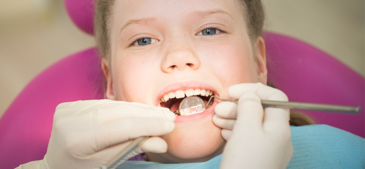 Lakowanie zębów jako jedna z najlepszych metod zapobiegania próchnicy
