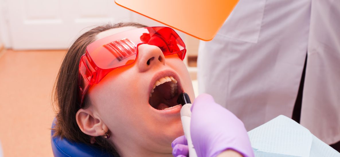 Jak wybrać lampę polimeryzacyjną do gabinetu stomatologicznego?