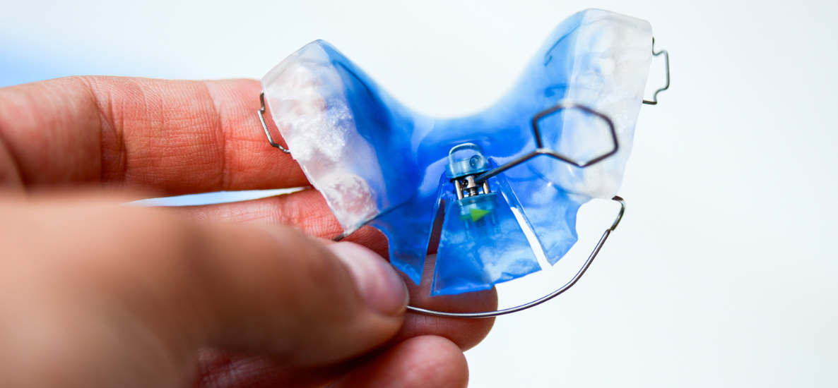 Asymetria twarzy a leczenie ortodontyczne – jak rozpoznać i jak leczyć?