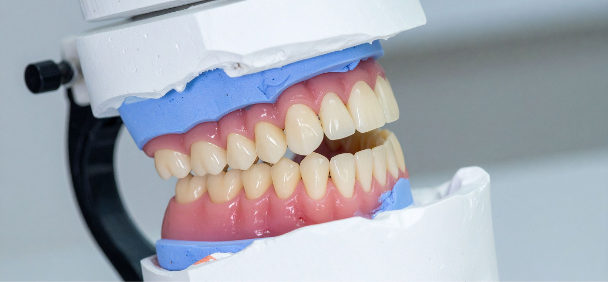 Profesjonalne czyszczenie protez w laboratorium – jakie preparaty wybrać?