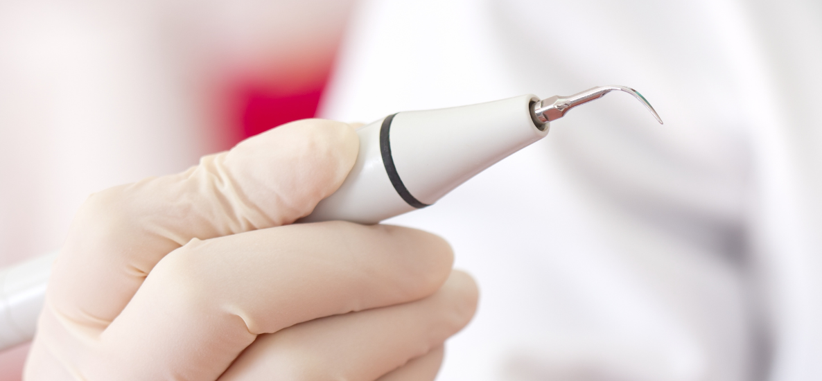 Jak działa skaling ultradźwiękowy - praktyczna wiedza dla stomatologów