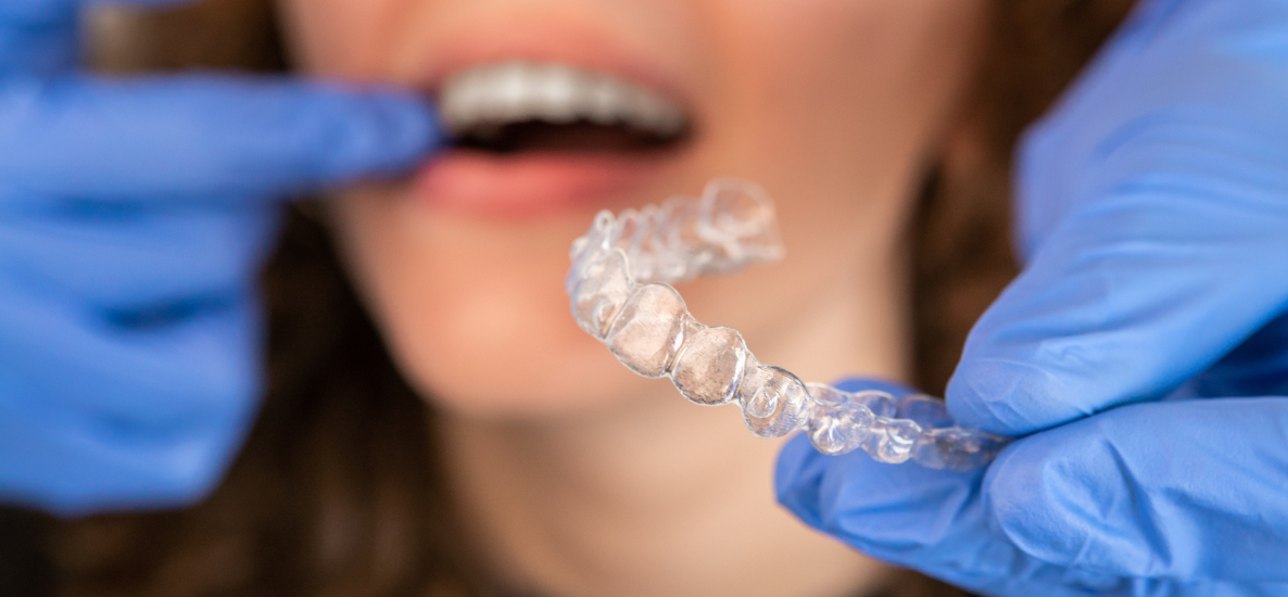 Jakie jest zastosowanie relaksyny w ortodoncji?