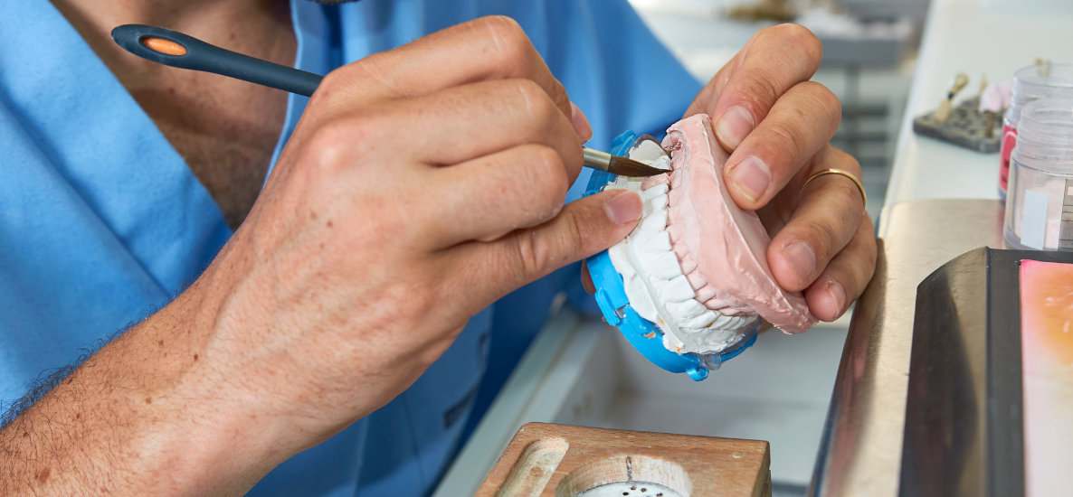 Akcesoria do modelowania ceramiki w protetyce – kluczowe narzędzia w pracy technika dentystycznego