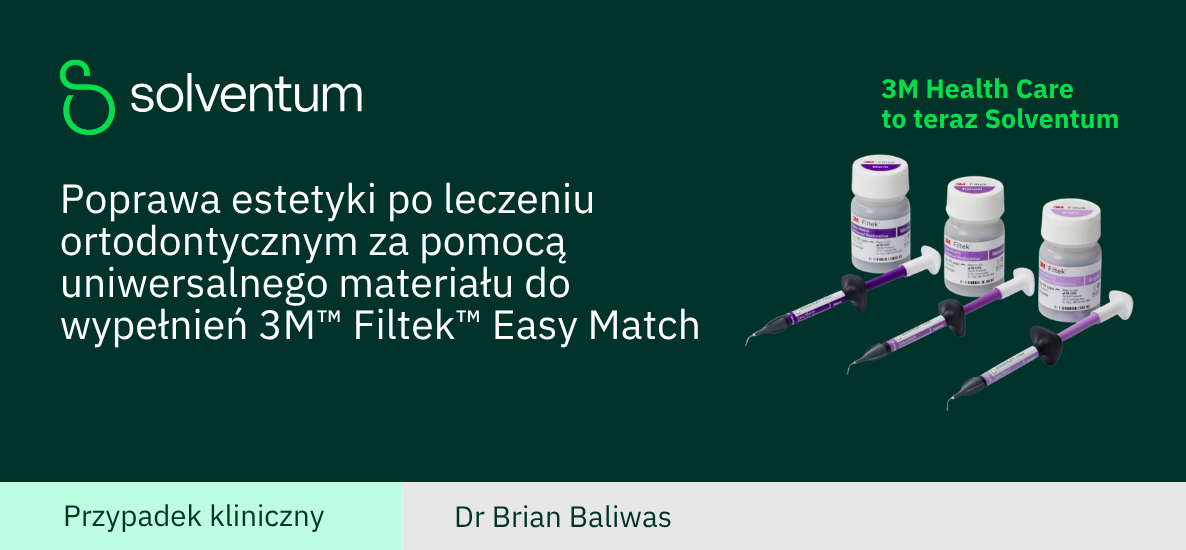 Poprawa estetyki po leczeniu ortodontycznym wykonana przez doktora Baliwasa