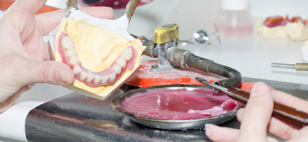 Najczęściej wybierane woski protetyczne – jak dopasować wosk modelowy do rodzaju pracy w laboratorium?