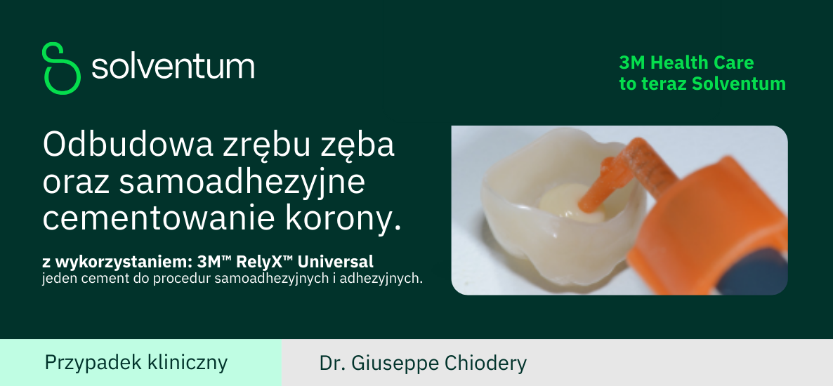 Odbudowa zrębu zęba oraz samoadhezyjne cementowanie korony