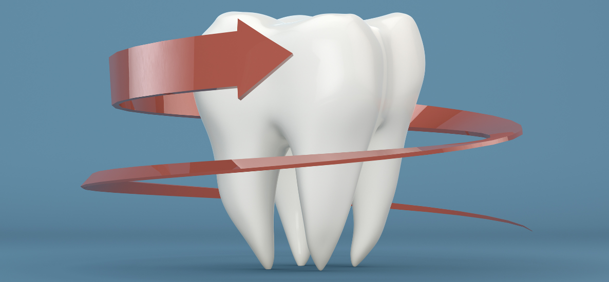 Remineralizacja - jak wzmocnić szkliwo zębów?