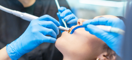 Hemisekcja zęba - co to za zabieg i jak przebiega?