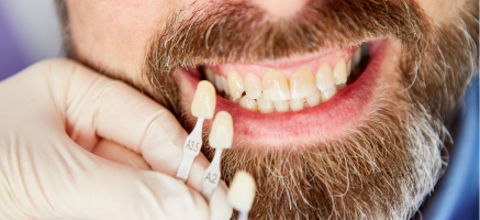 Przebarwienia zębów - skąd się biorą i jak z nimi walczyć?